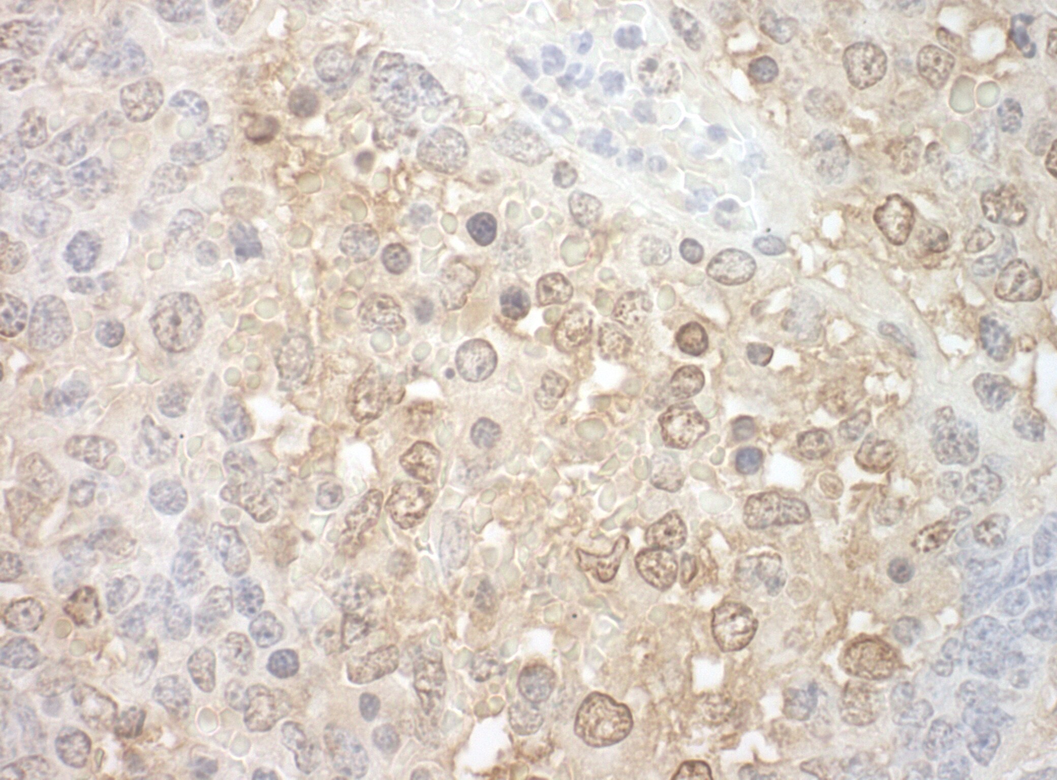 TFIP11 Antibody
