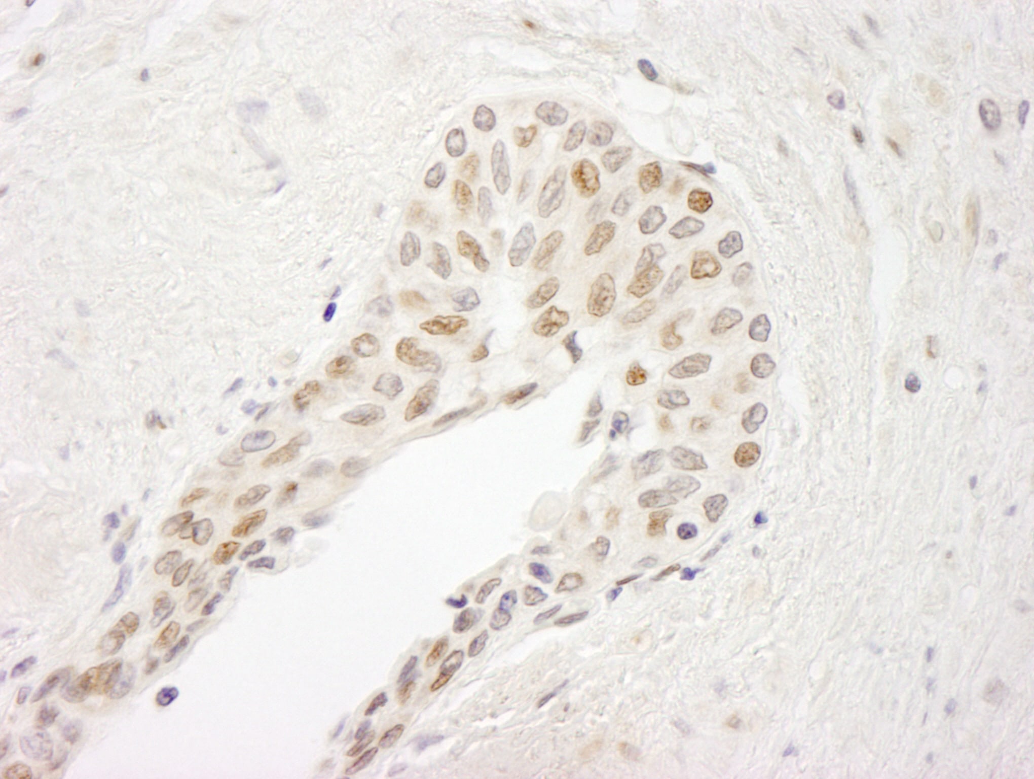 ATRIP Antibody