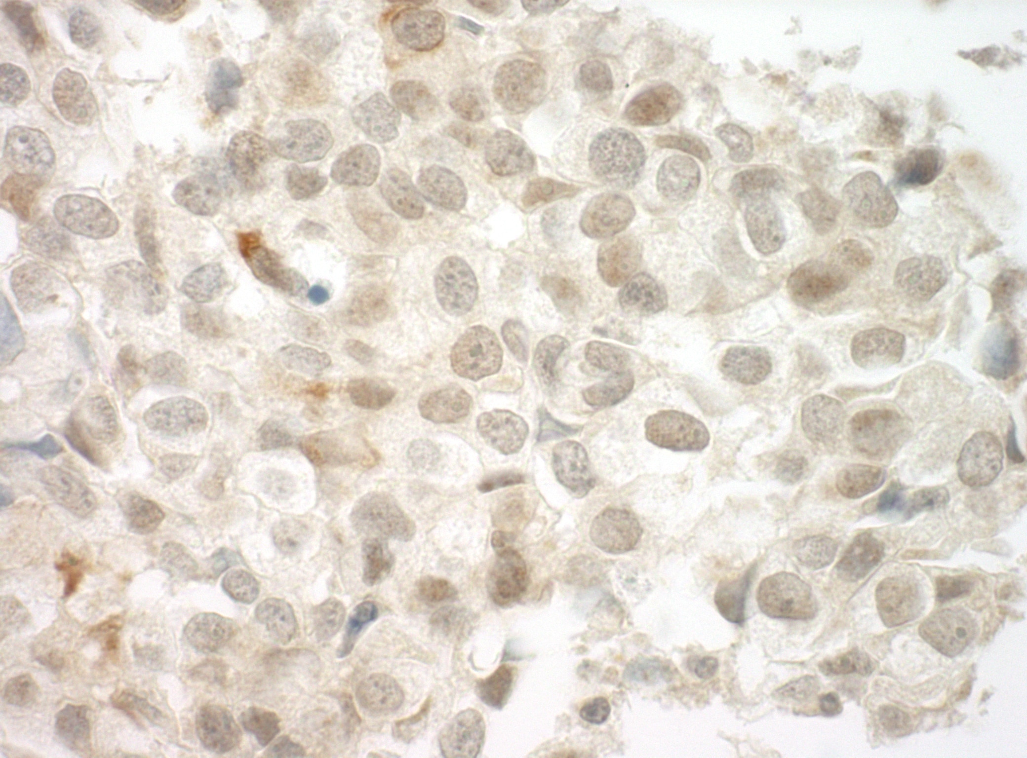 PRCC Antibody