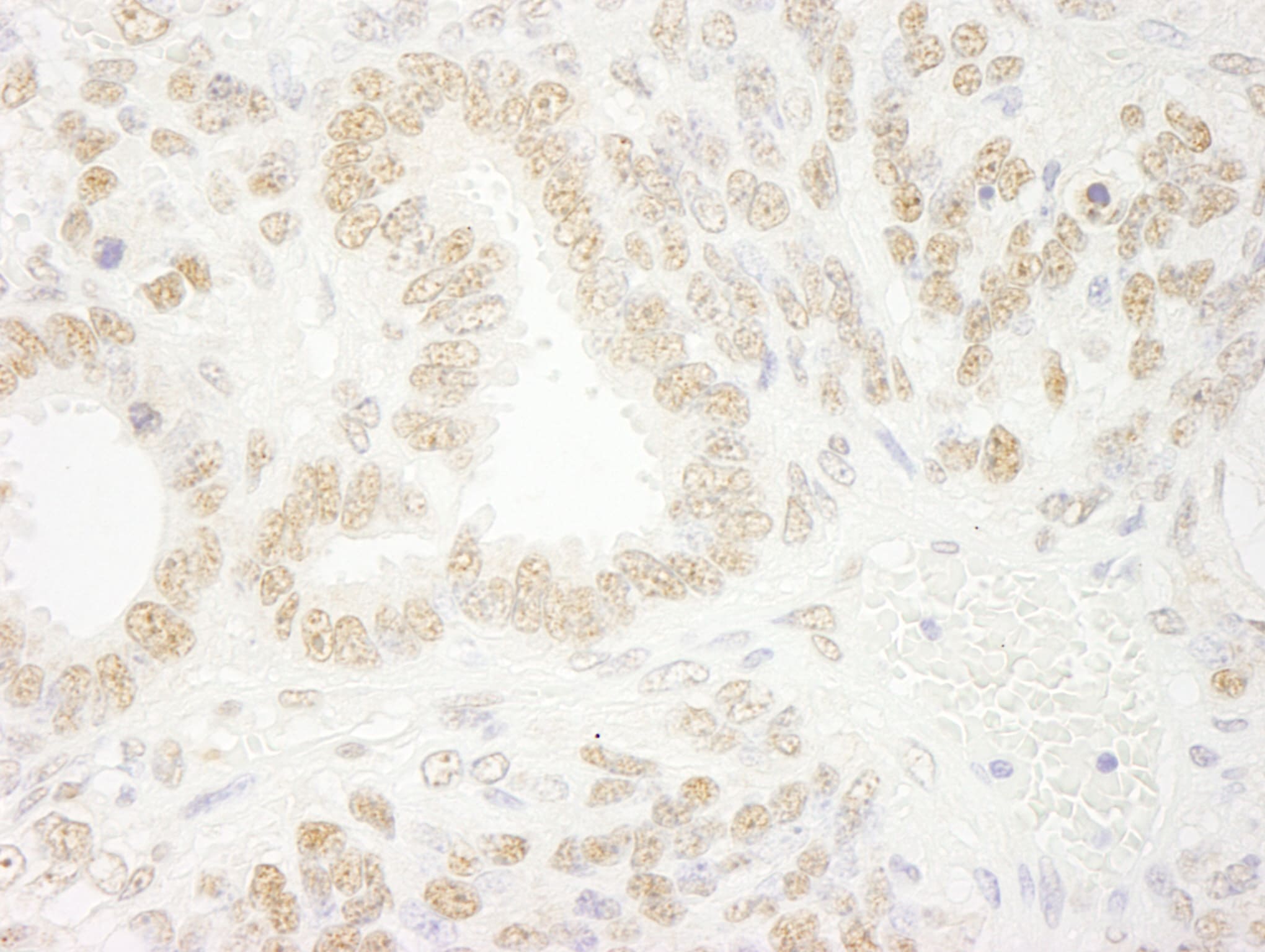 ZNF198 Antibody