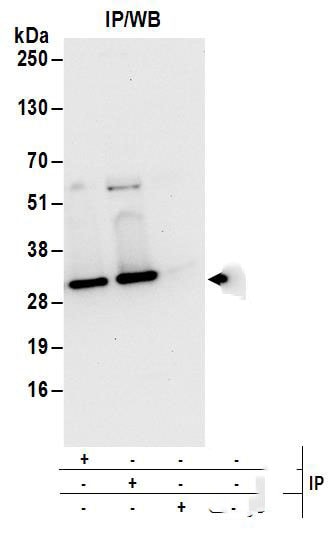 UBE2S Antibody