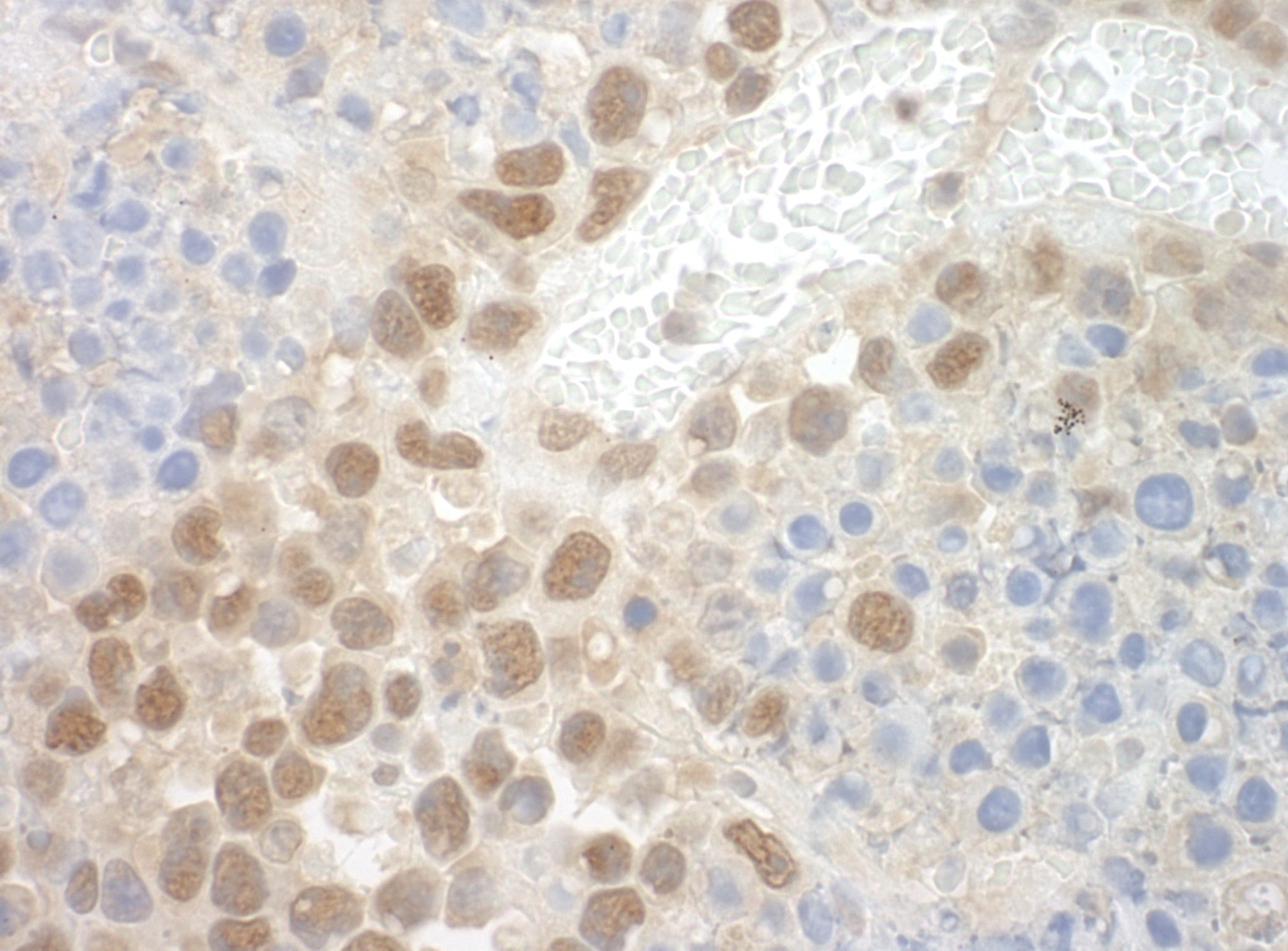 POGZ Antibody