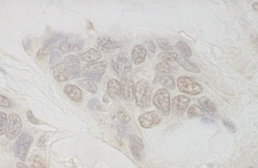 Intron-Binding Protein Of 160 KDa Antibody