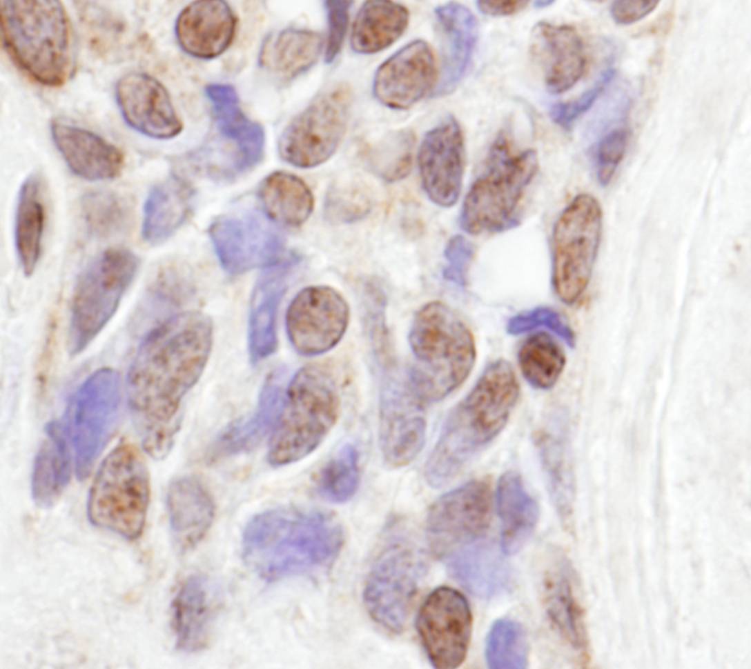 RBM14 Antibody