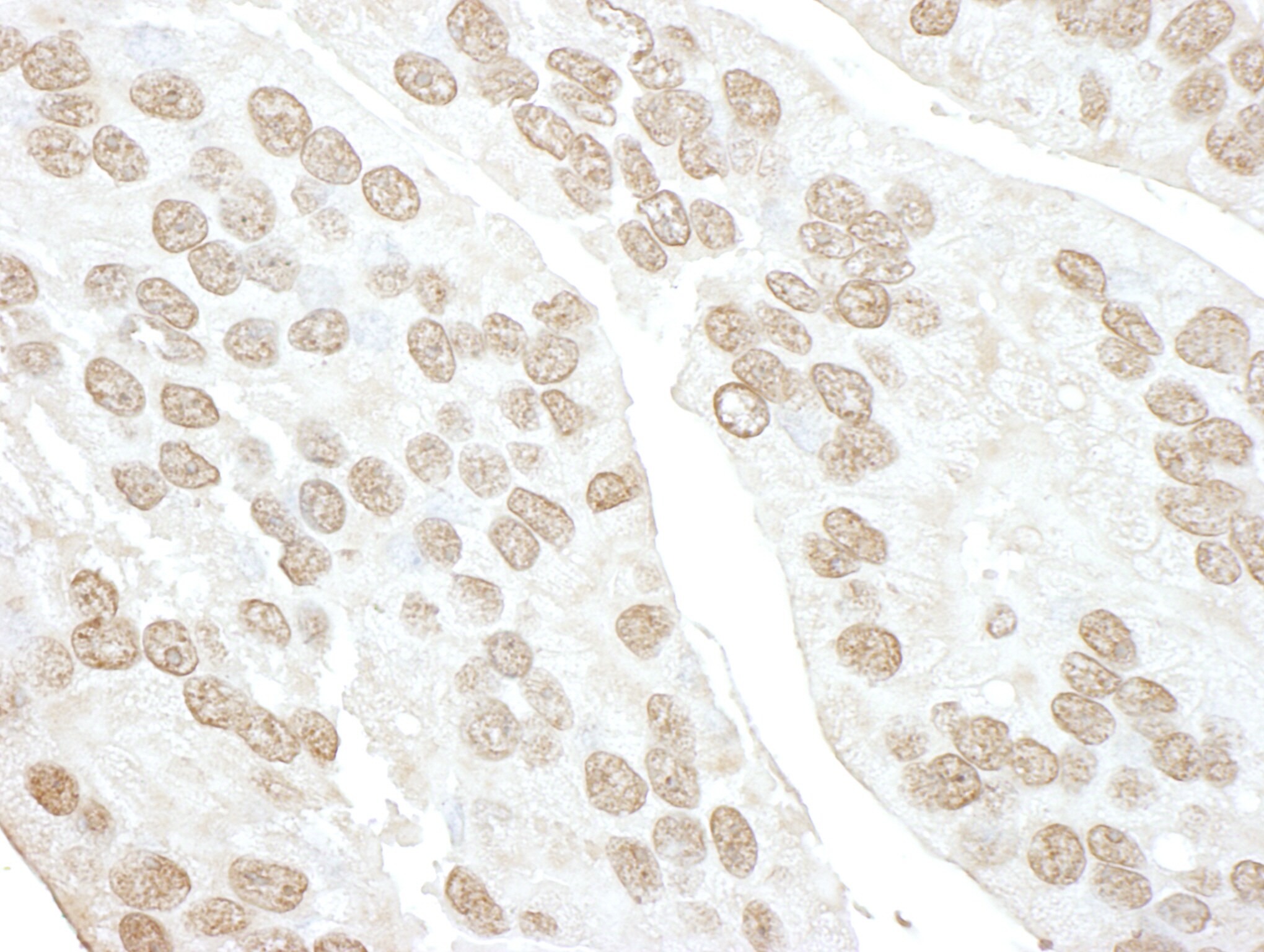 POLR3D Antibody