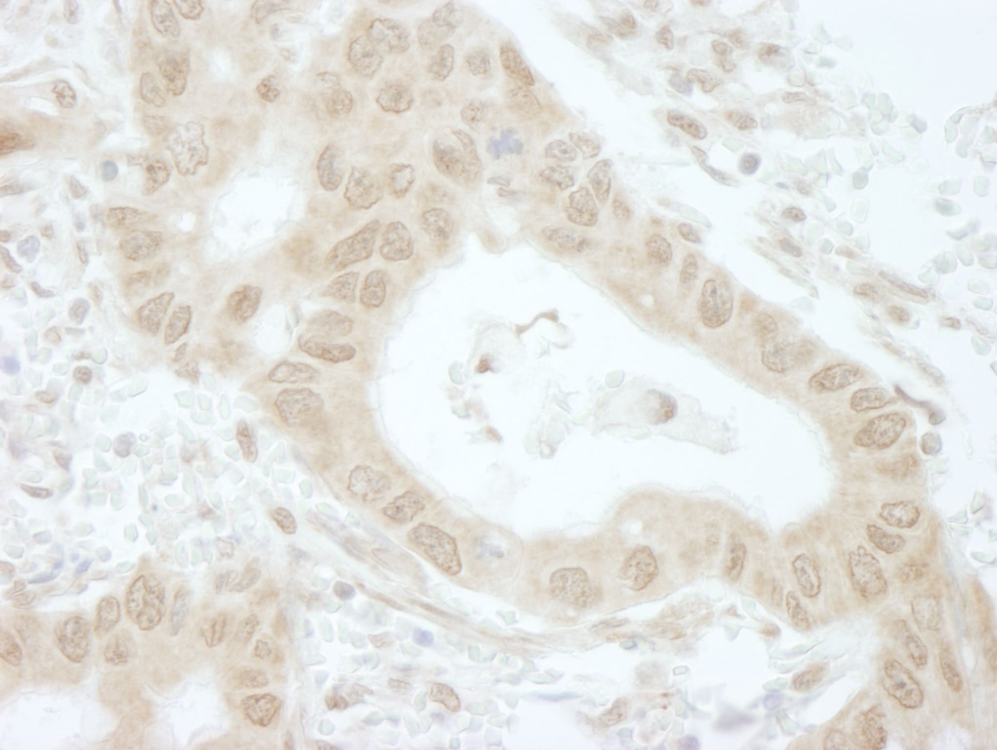 TIPRL Antibody