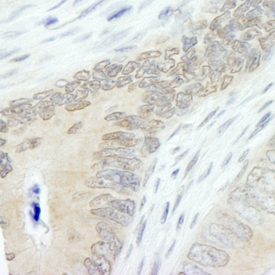 HUWE1 Antibody