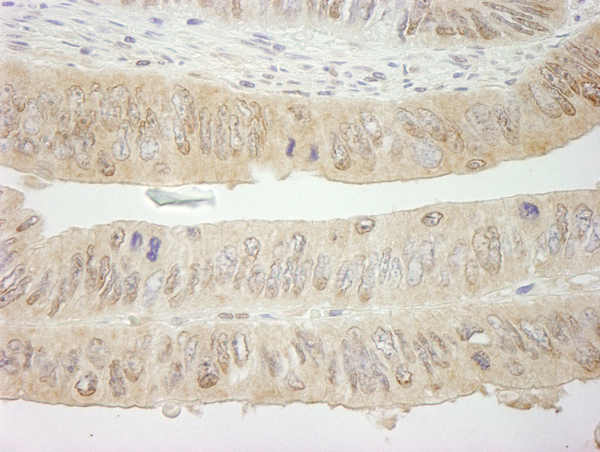 SYK Antibody