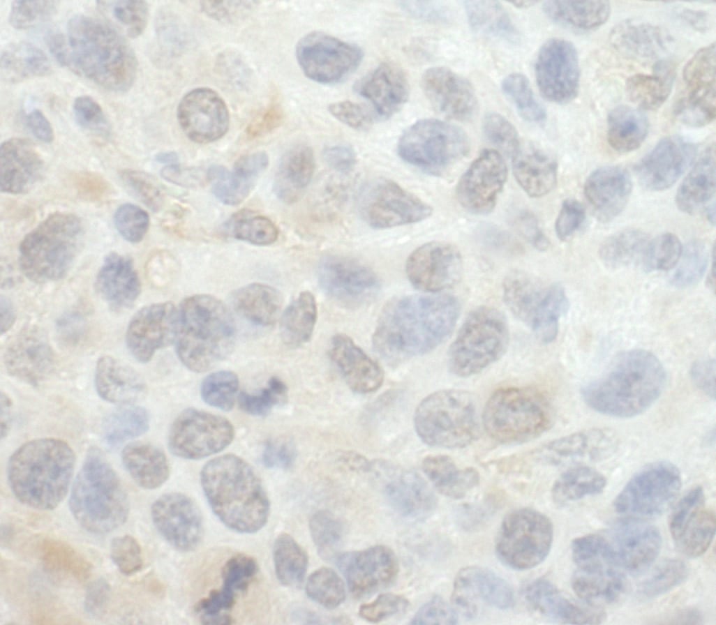 SRPK1 Antibody