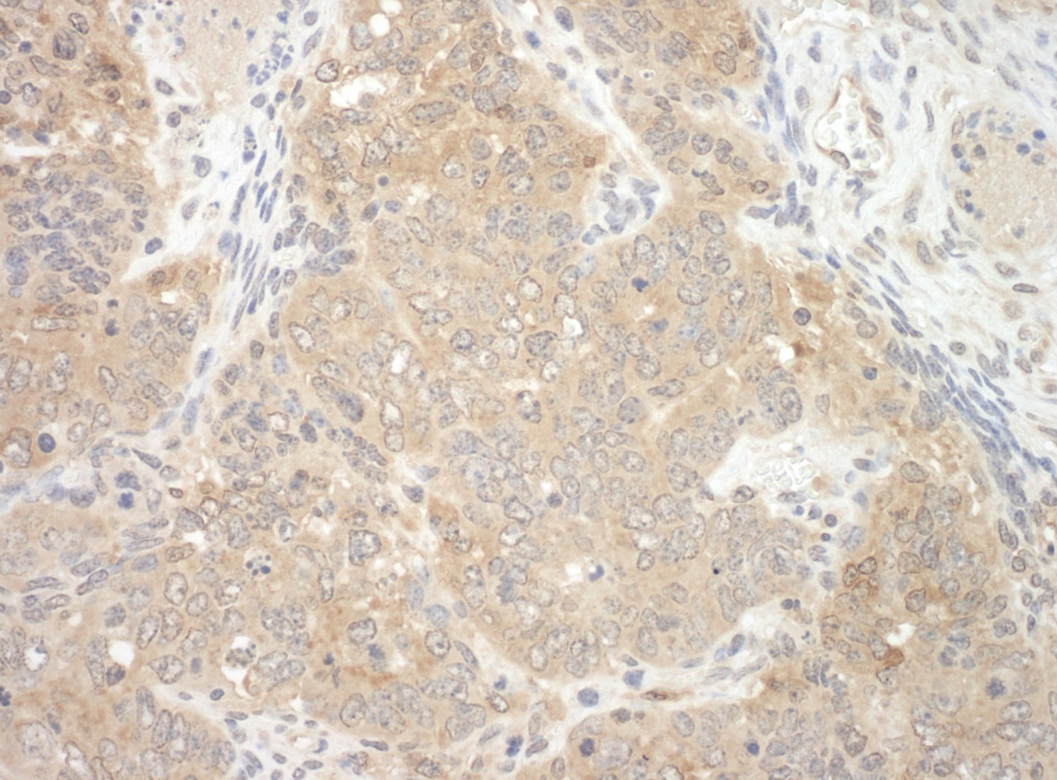NEDD4L Antibody