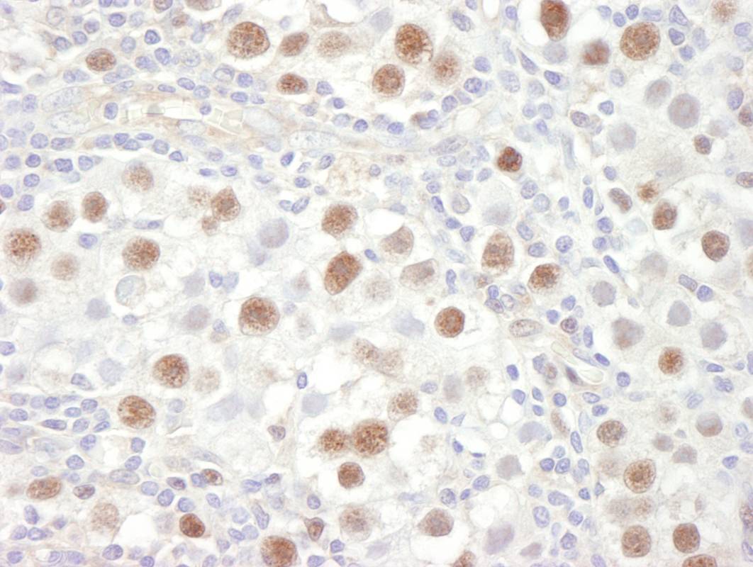 MCM4 Antibody