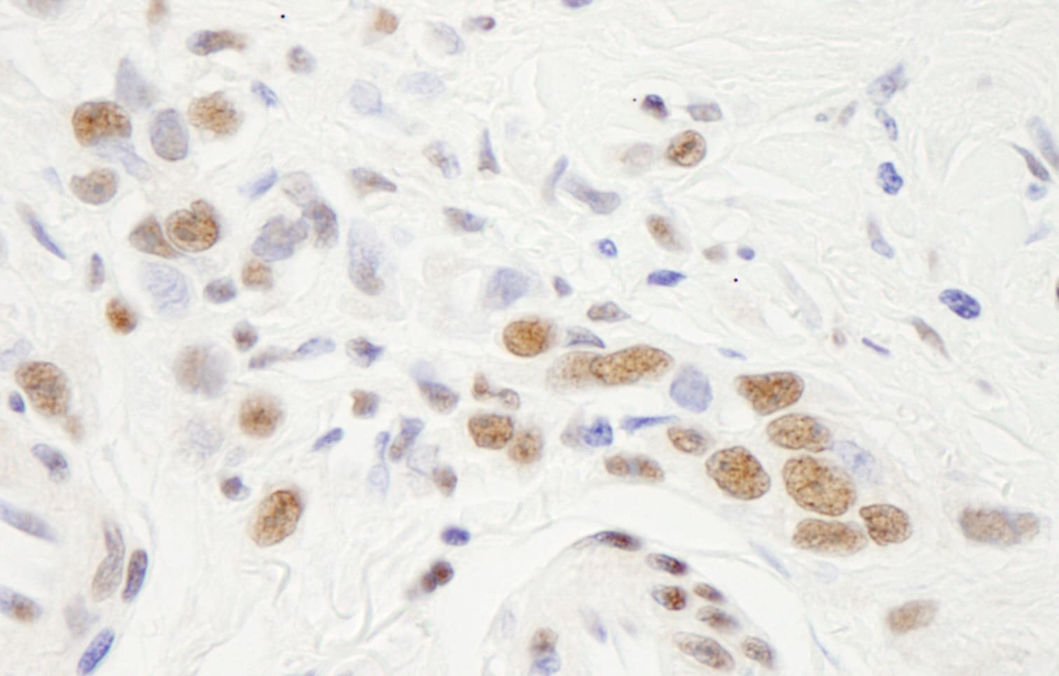 NFYA Antibody