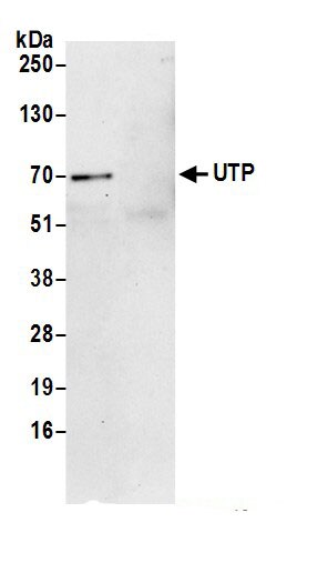 UTP15 Antibody