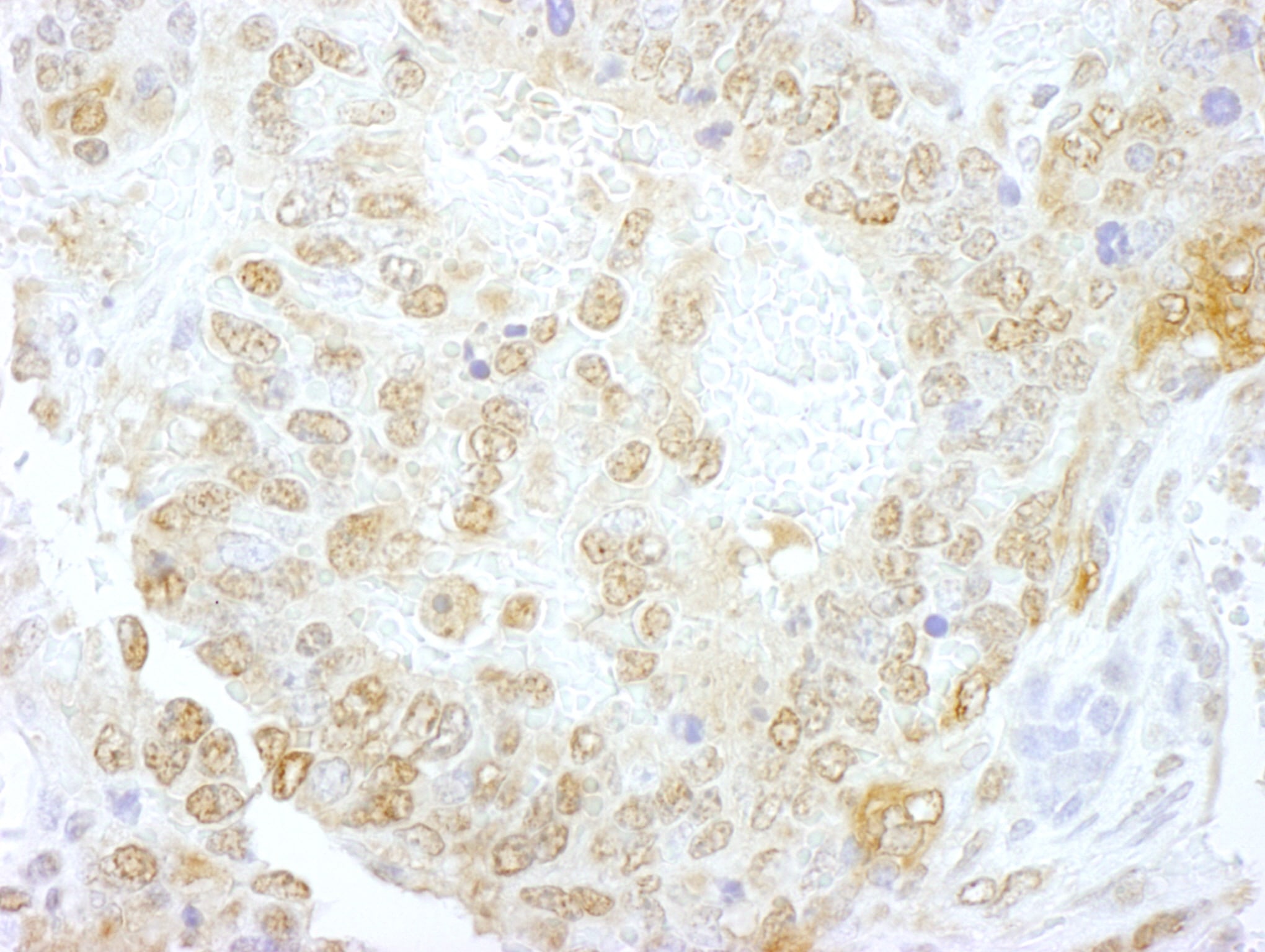 NCBP1 Antibody