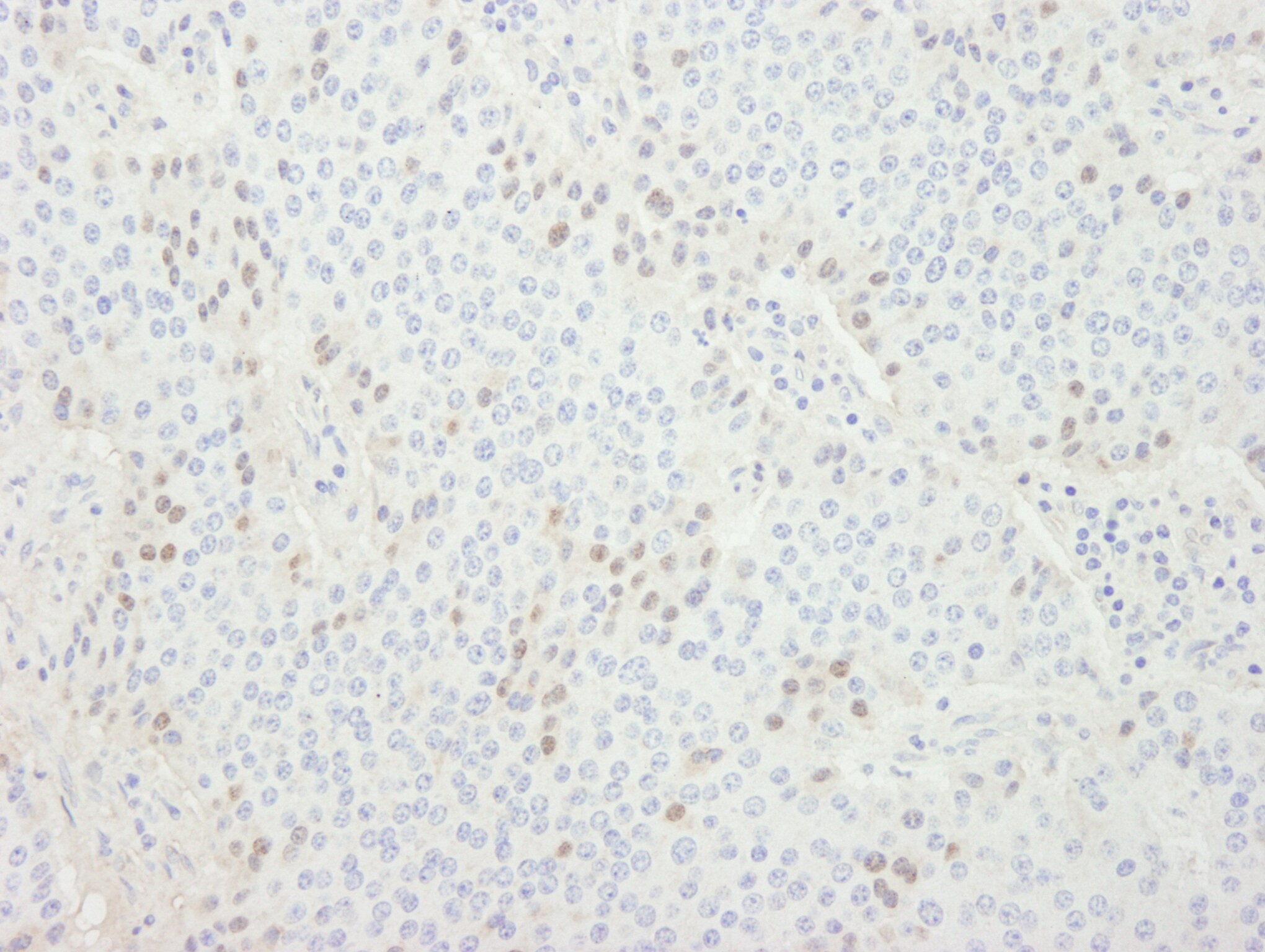 CDT1 Antibody