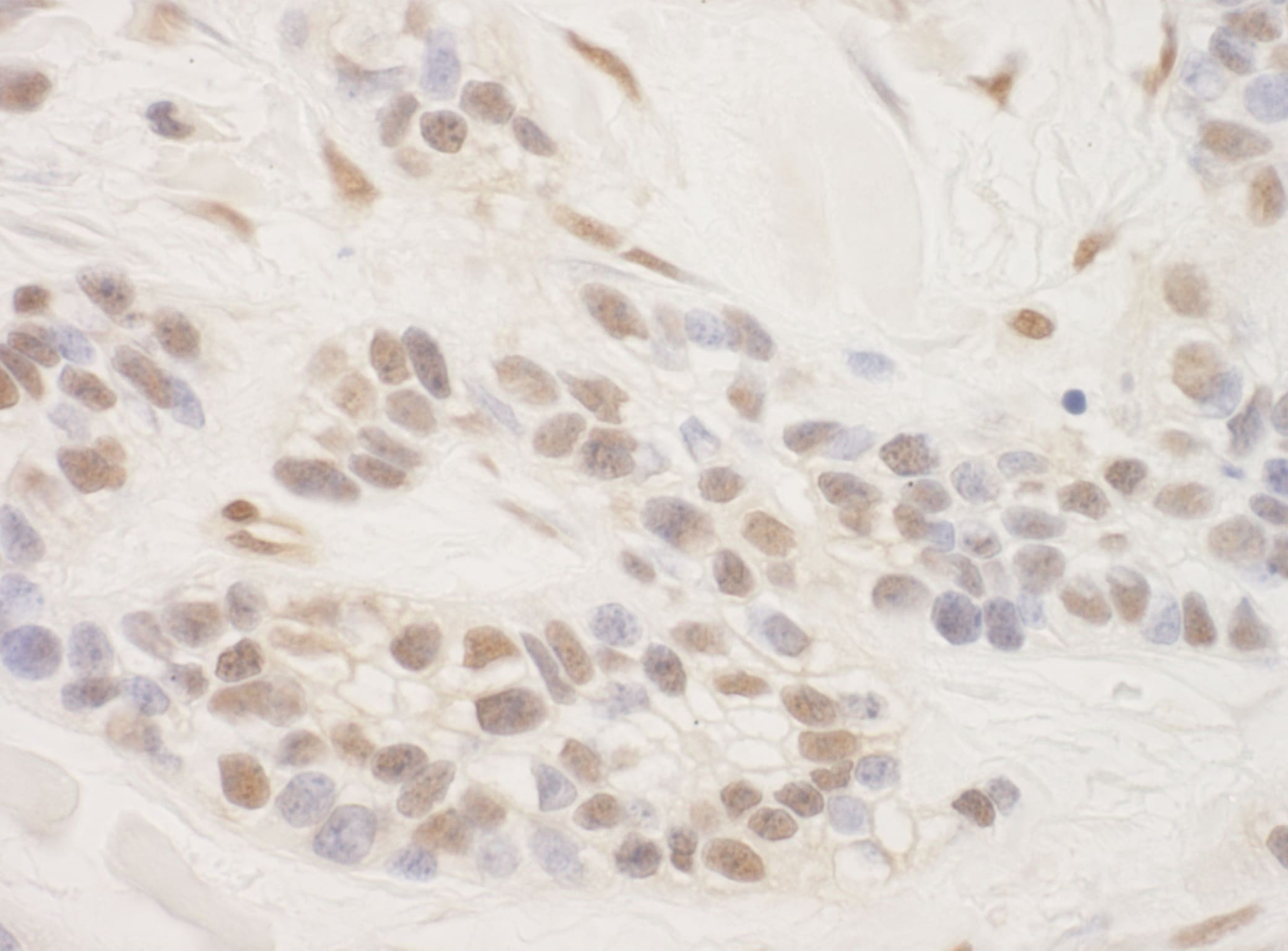 TORC3/CRTC3 Antibody