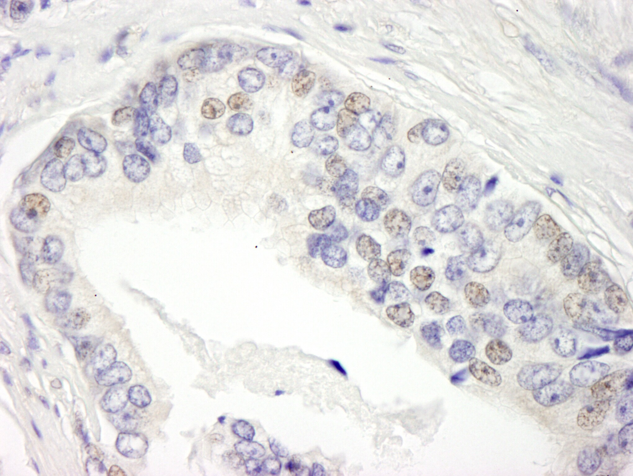 BRD3 Antibody