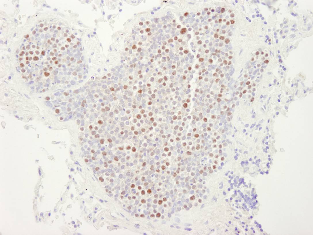 MCM4 Antibody