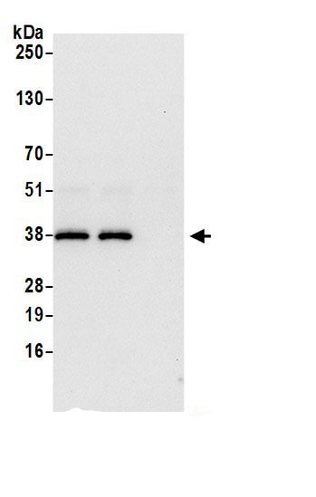 DCPS Antibody