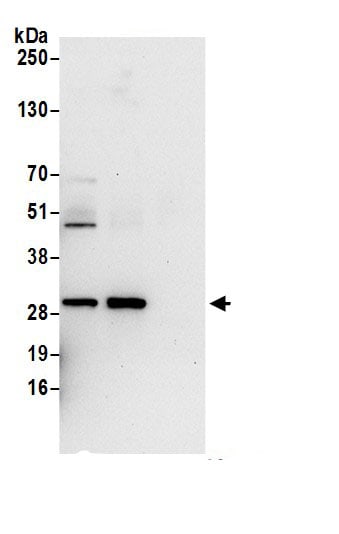 UCK2 Antibody