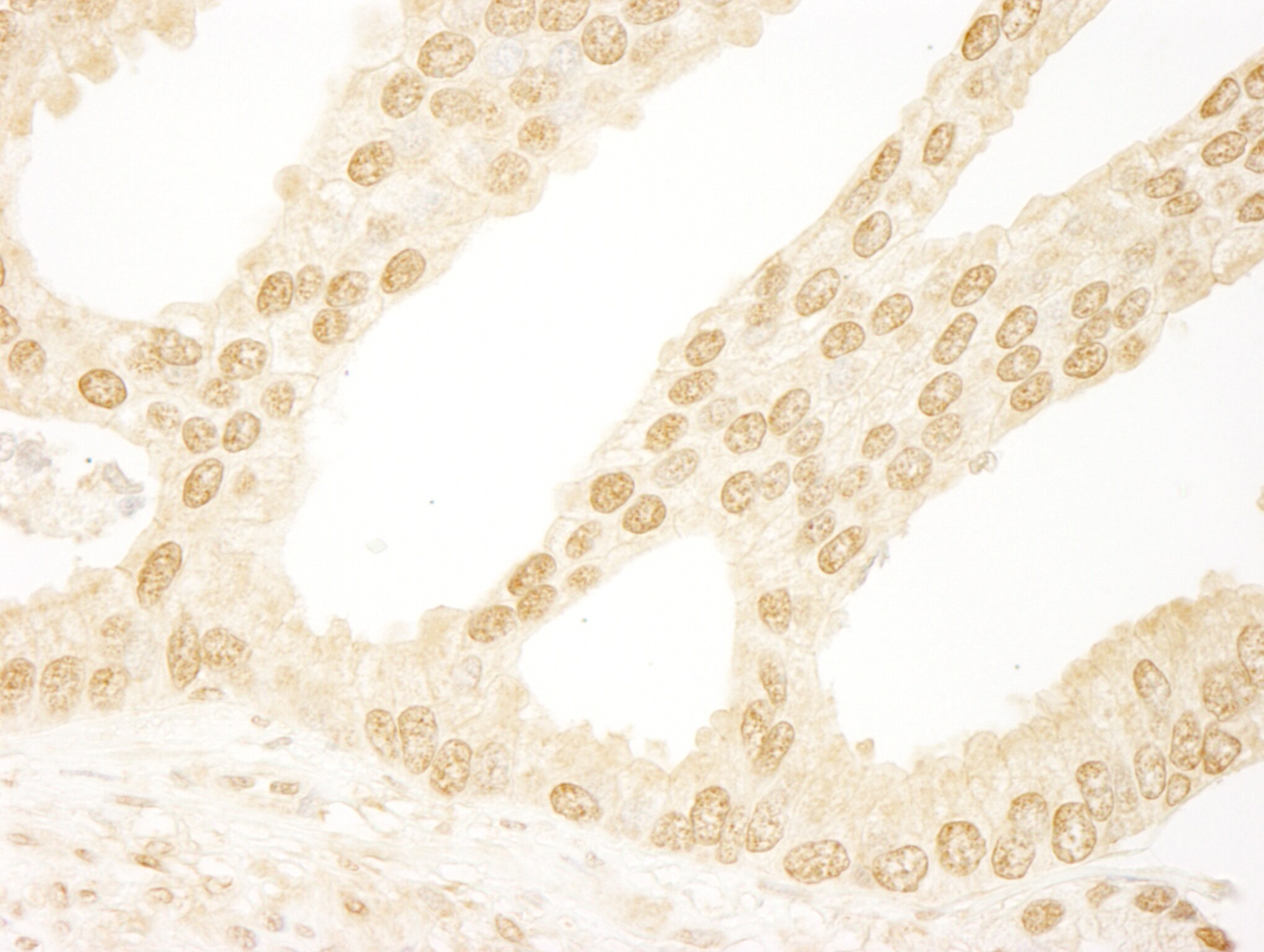 INTS6 Antibody