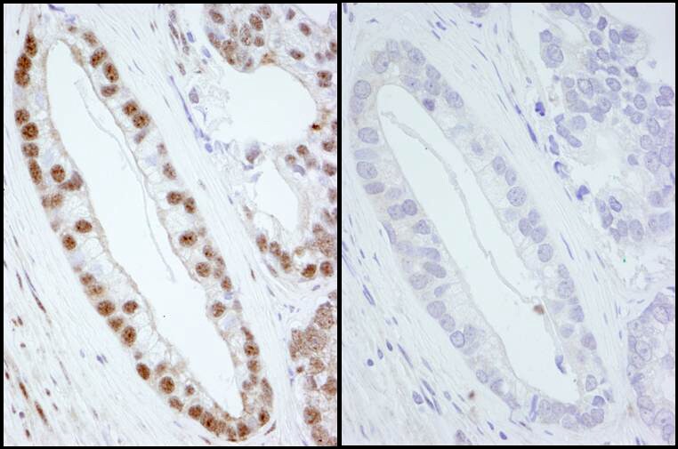 SMC1 Antibody