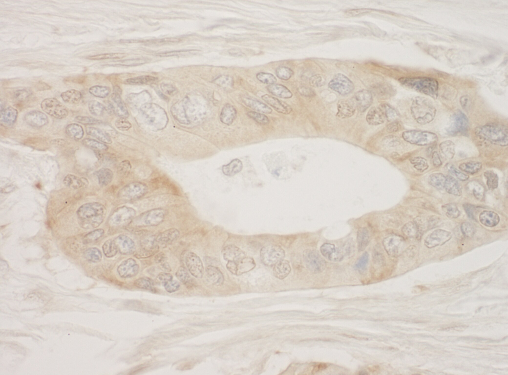 RSK2 Antibody