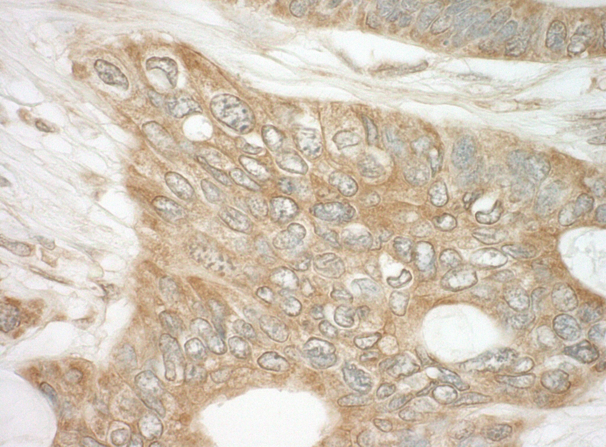 DAP5 Antibody