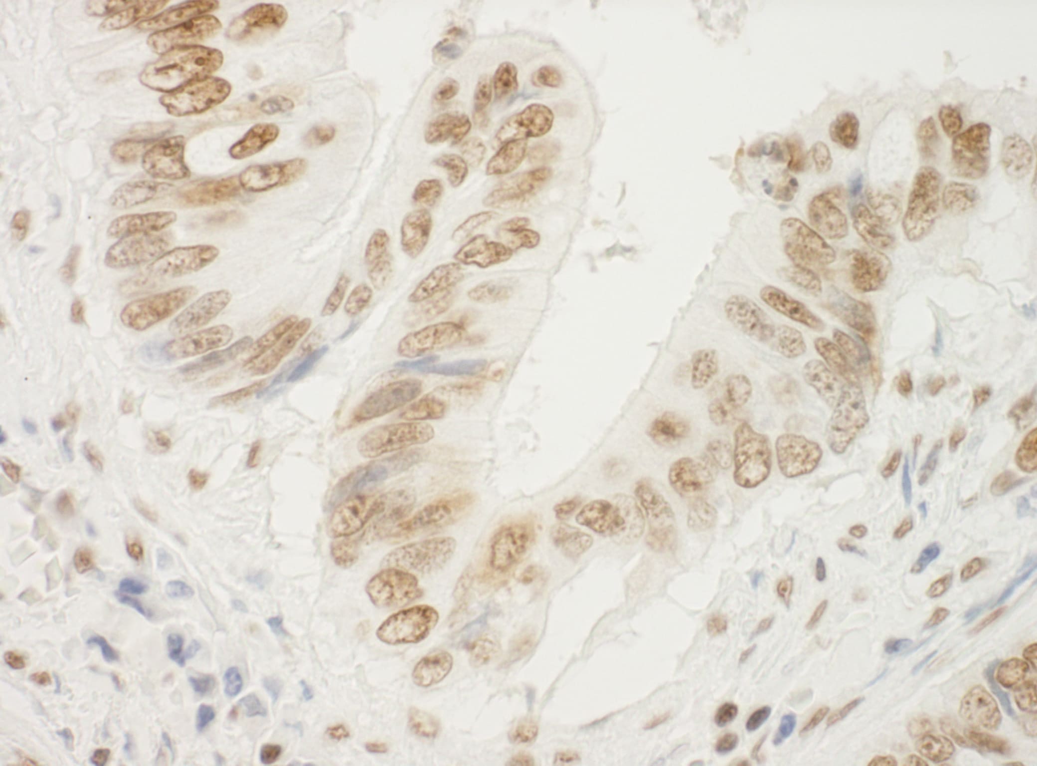 NPM1 Antibody