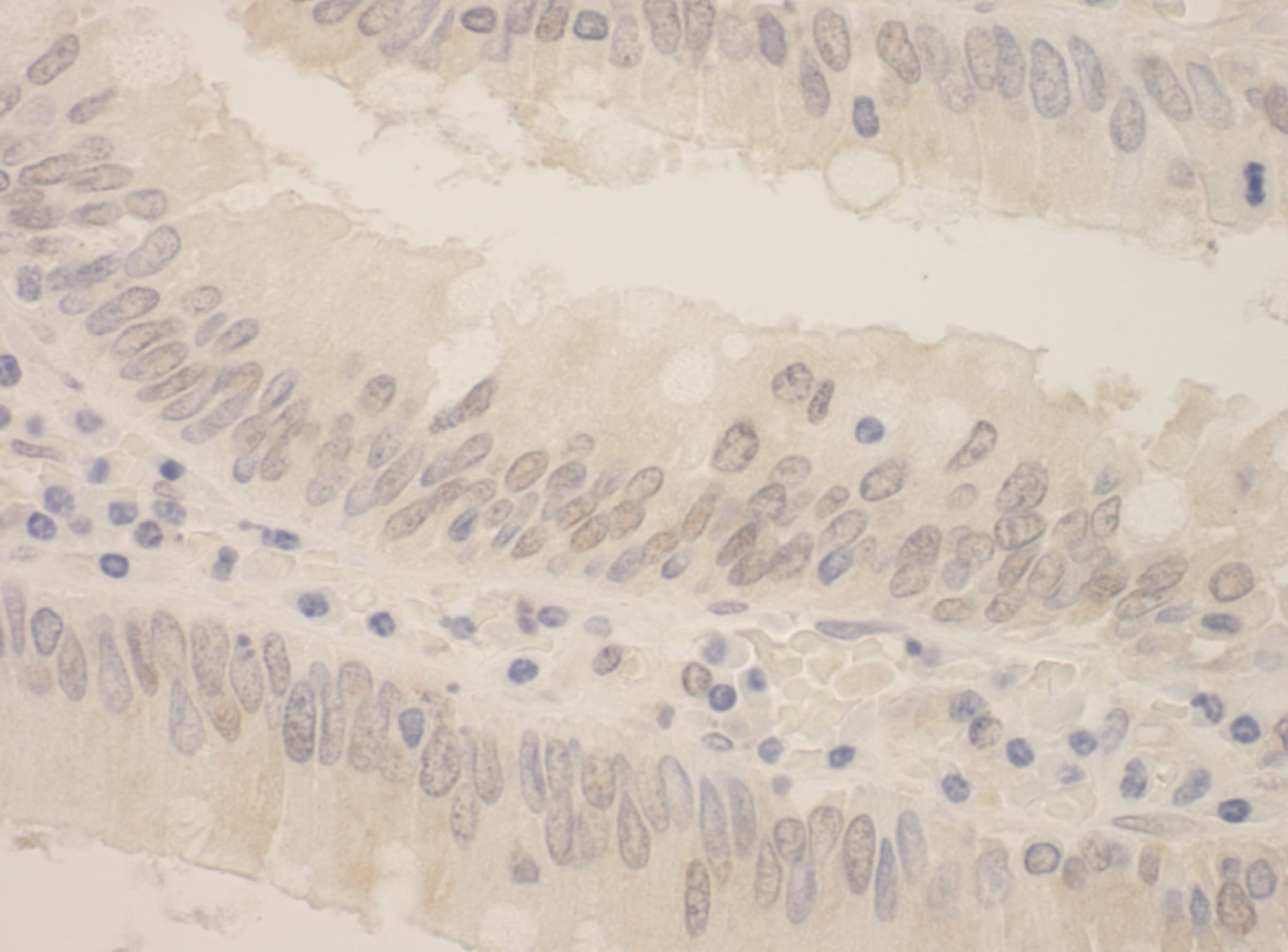SRPK2 Antibody