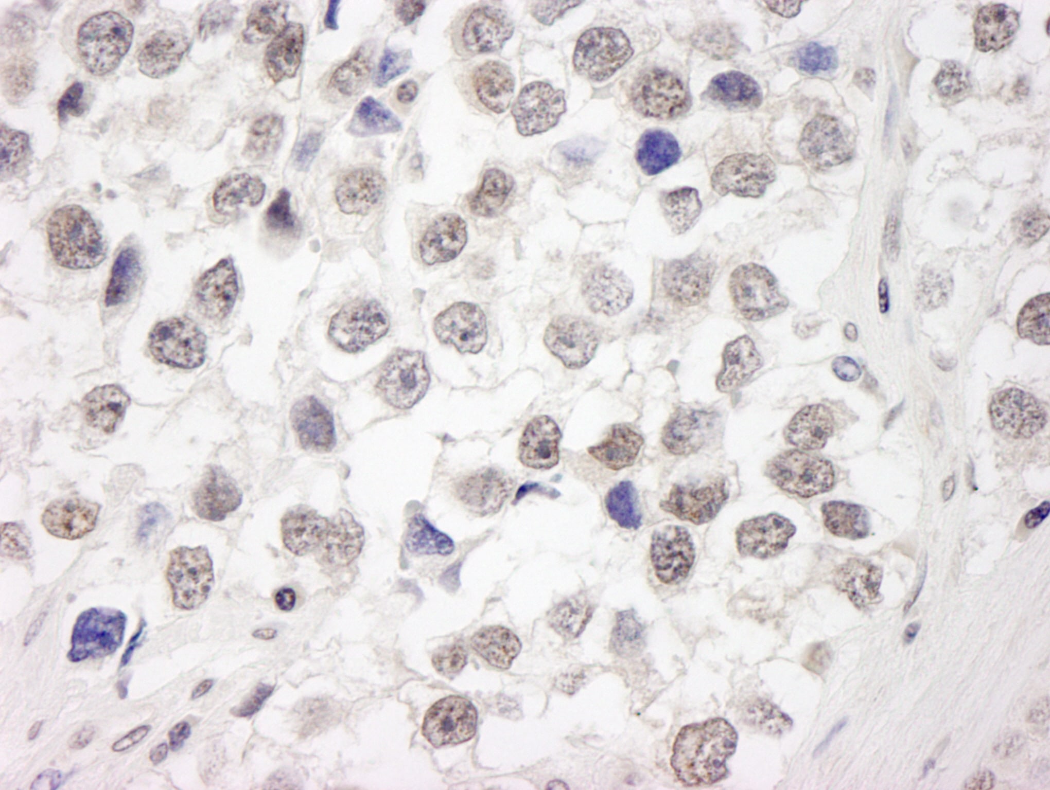 RAP80 Antibody