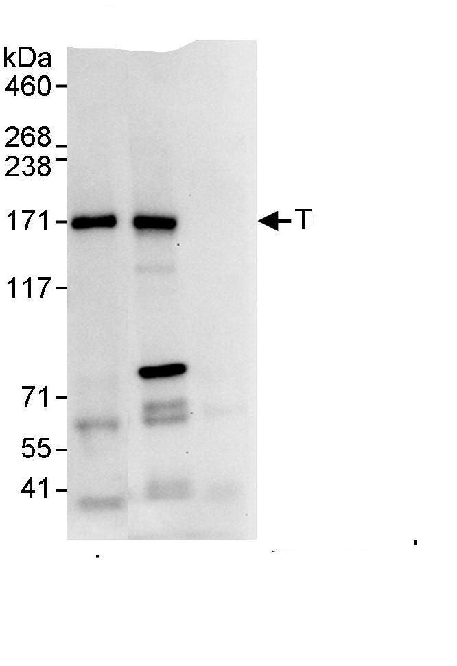 Tankyrase 1 Antibody