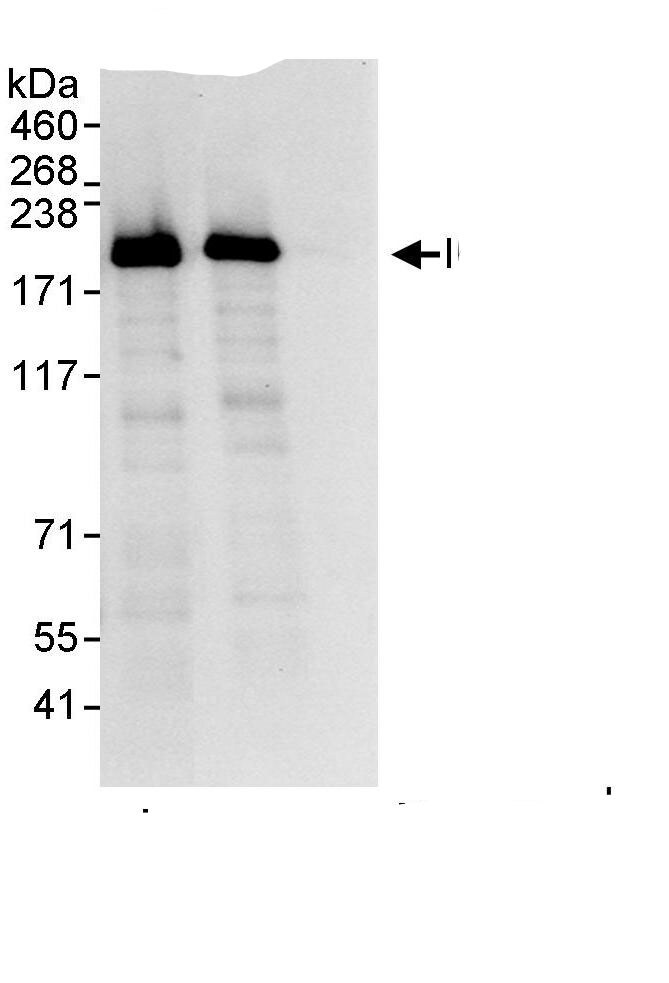 Intron-Binding Protein Of 160 KDa Antibody