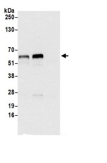 Asparagine synthetase Antibody