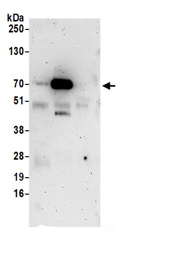FKBP10 Antibody