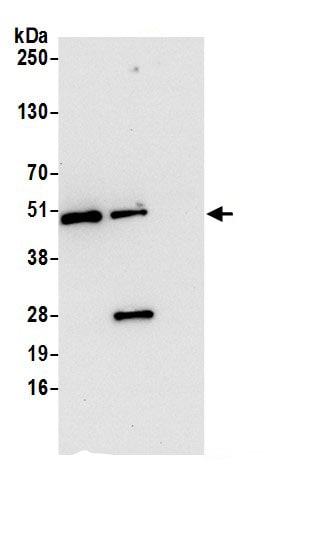 KAT1 Antibody