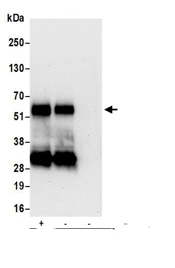 Lymphotoxin beta R/TNFRSF3 Antibody