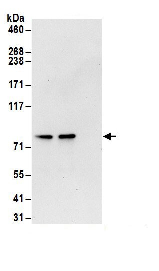 Transglutaminase 2/TGM2 Antibody