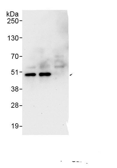 BCKDHA Antibody