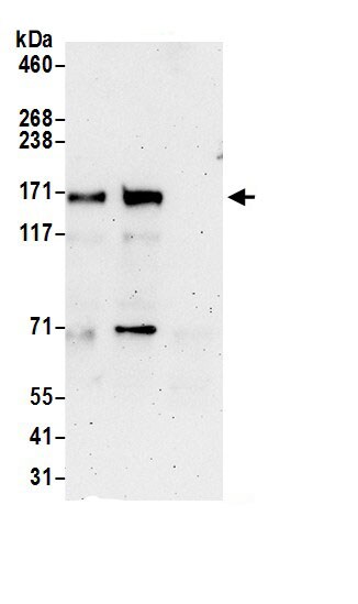 LDLR Antibody