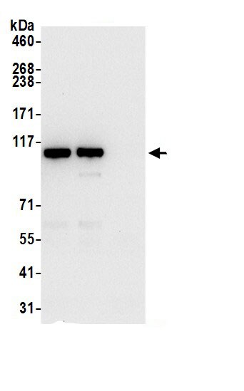 PITRM1 Antibody