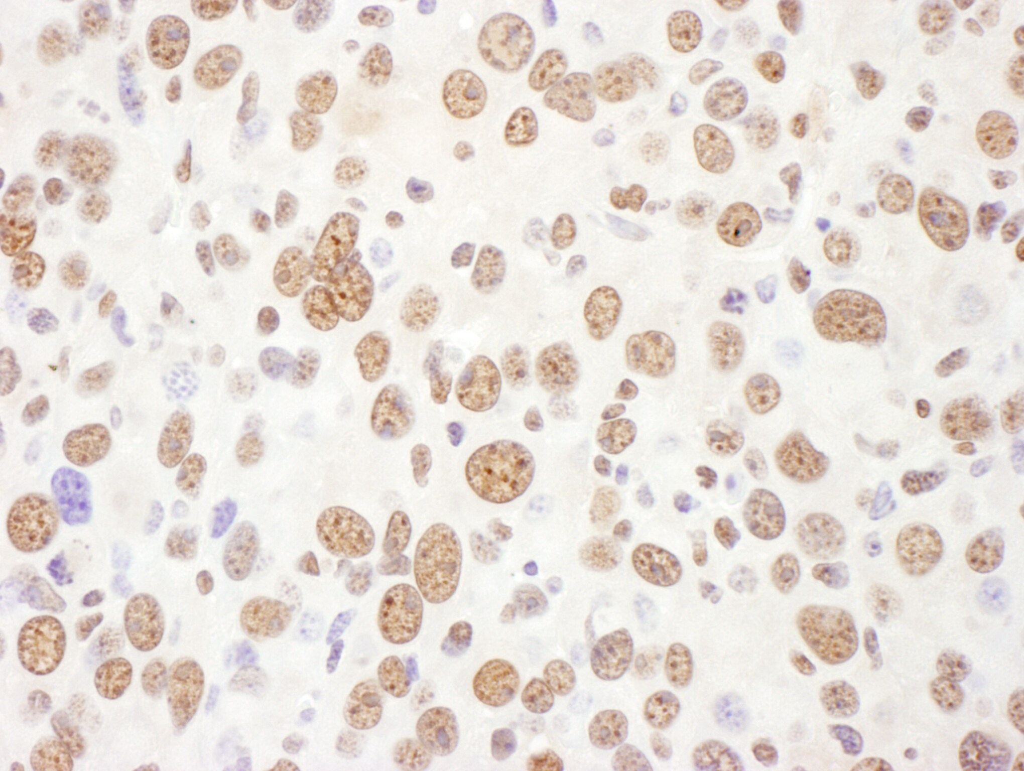 EIF4A3 Antibody