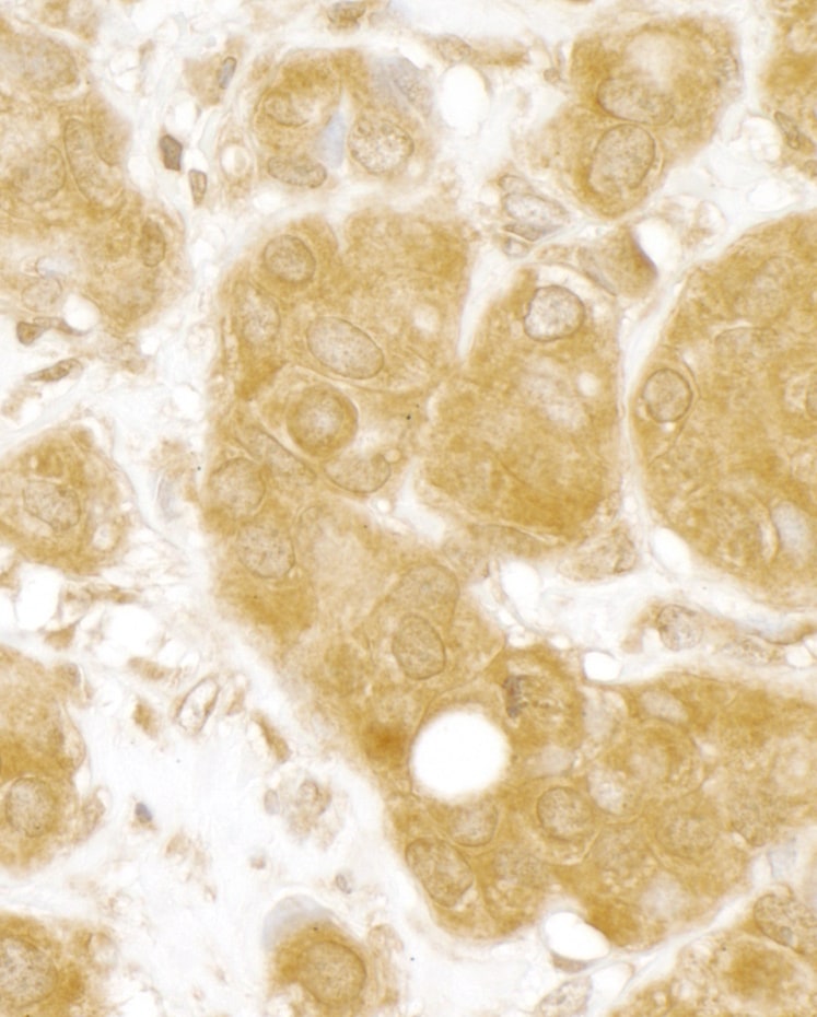 MERIT40/HSPC142 Antibody