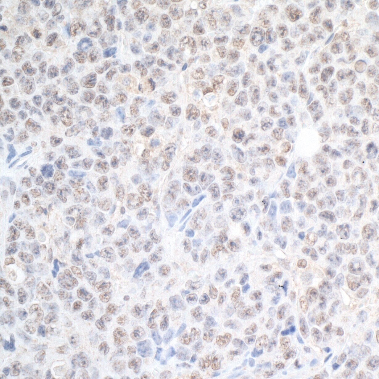 RBM17 Antibody