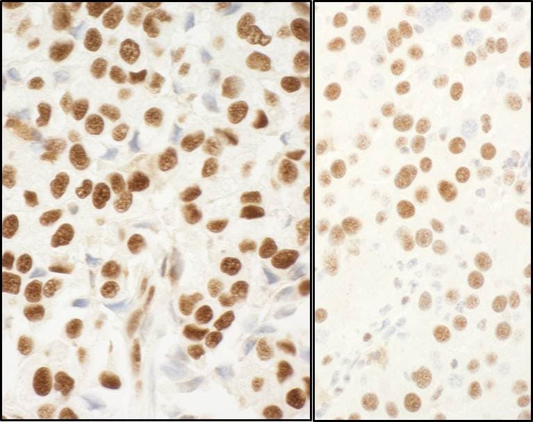 NPM1 Antibody
