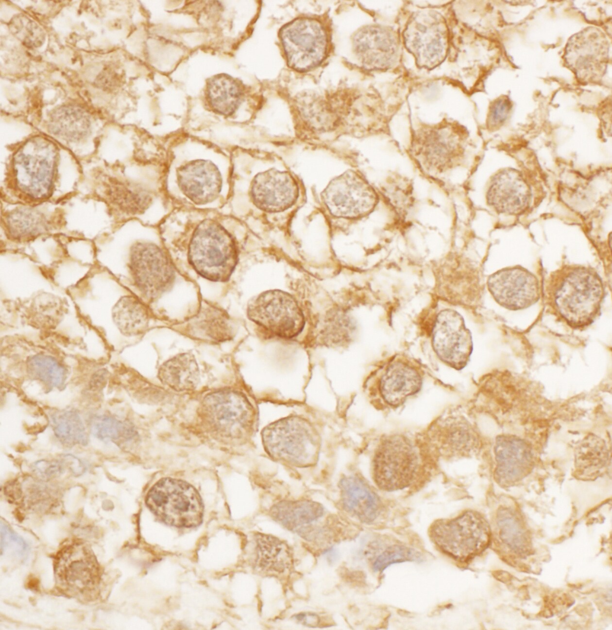 CDC42EP4 Antibody
