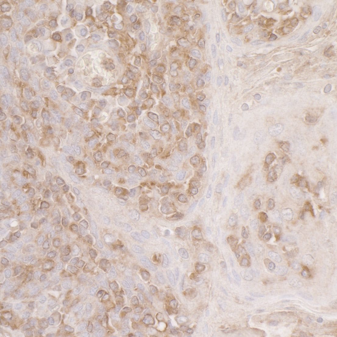 ACTR2 Antibody