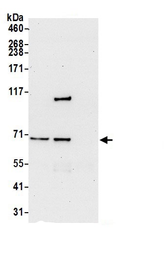 ATP6V1A Antibody