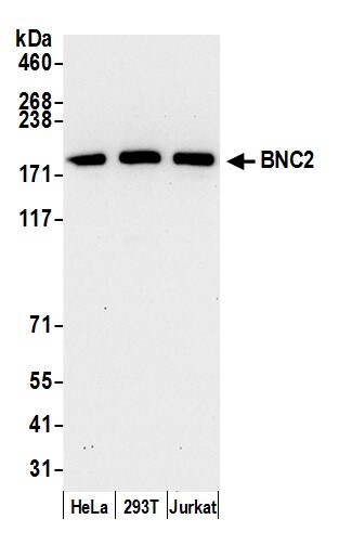 BNC2 Antibody