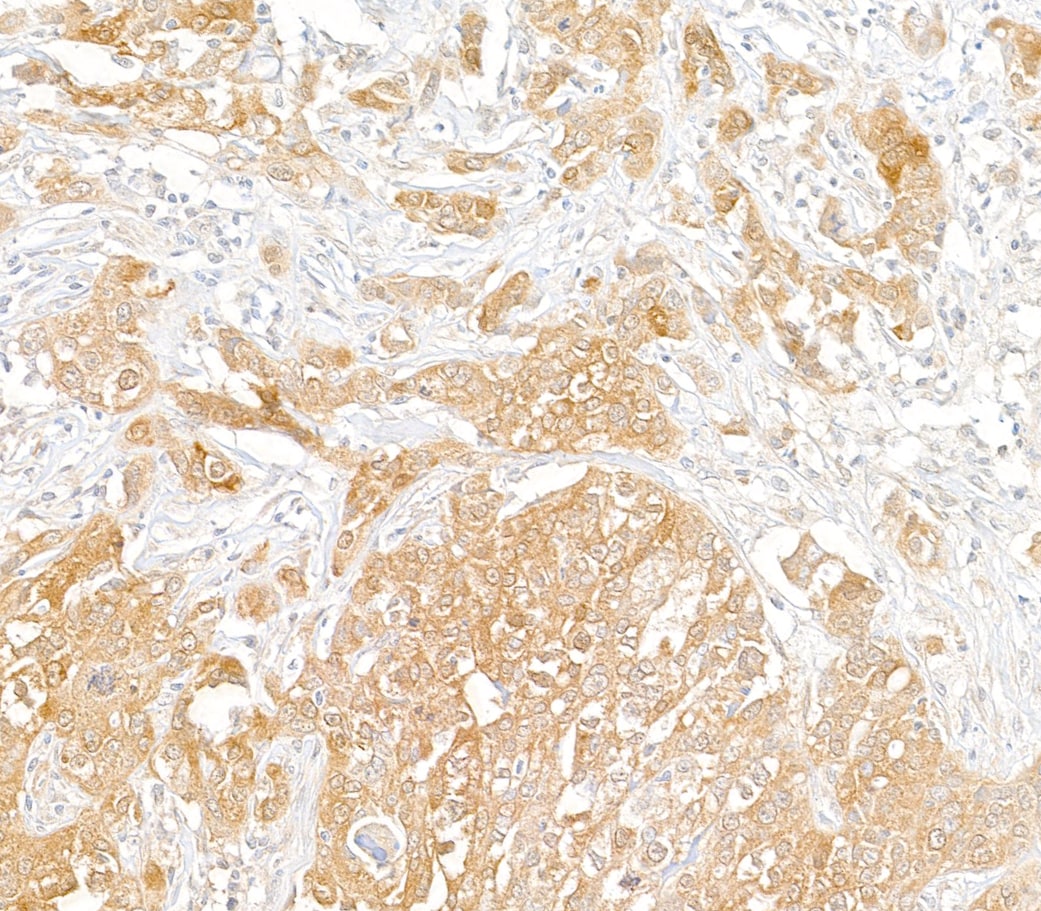 PHGDH Antibody